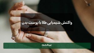 واکنش شیمیایی طلا با پوست بدن | جواهری عبدالهی